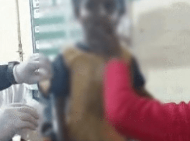 Ludhiana: Fire breaks out in house due to rat, 4 including 3 children suffer burns, accident occurs while cooking