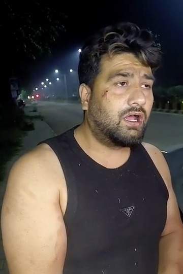 Bloody brawl in Jalandhar salon: Customer attacked with razor, police investigating based on CCTV footage